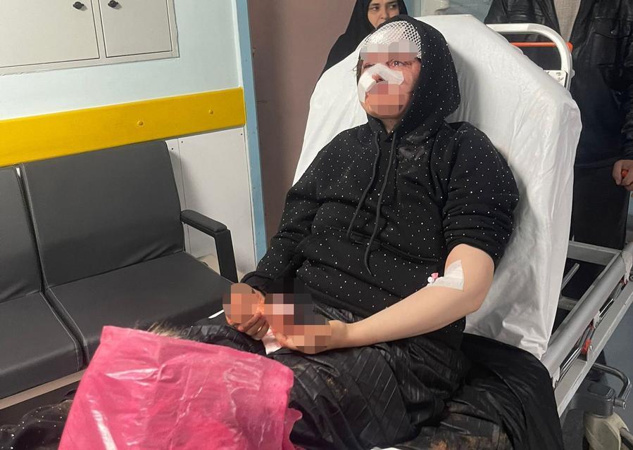 Boşanmak isteyen kadın eşi tarafından öldüresiye darp edildi