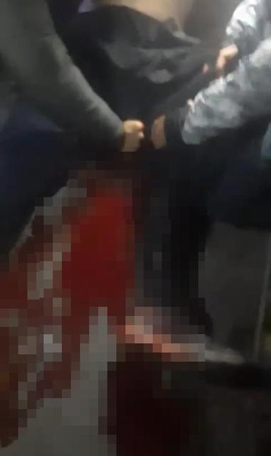 Yüksek sesli müzik kavgası: 1yaralı