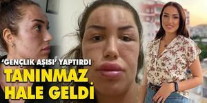 İzmir'de yaşayan 24 yaşındaki Seline Ferah Çalışkan, "gençlik aşısı" adı altındaki işlem sonrası yüzünde ve boynunda yüzlerce nodül oluşunca uygulamayı yapan güzellik merkezinin sahibi hakkında suç duyurusunda bulundu.  ( Aile albümü - Anadolu Ajansı )