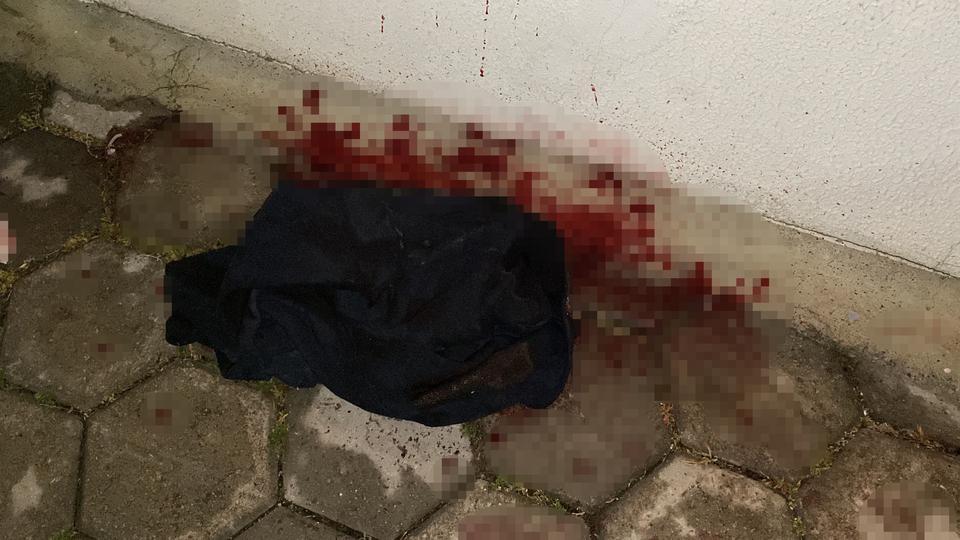 YAN BAKMA KAVGASINDA 17 YAŞINDAKİ ÇOCUK BIÇAKLANDI