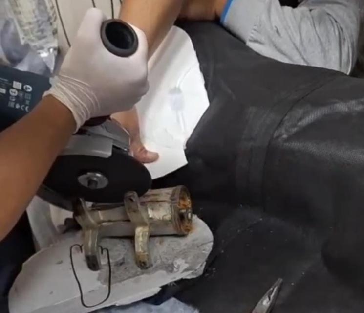 8 yaşındaki çocuk elini kıyma makinesine kaptırdı
