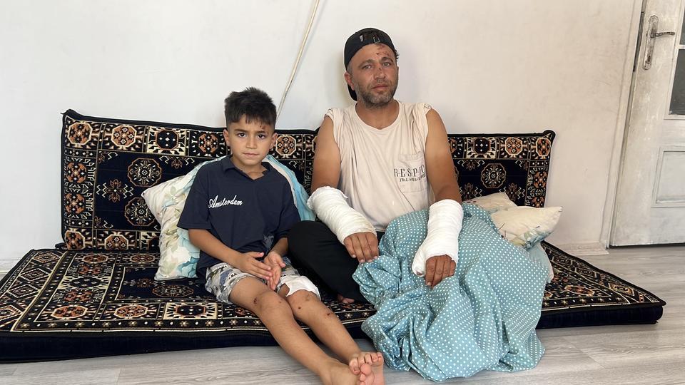 "İki kolum alçıda, vücudumuzun çeşitli yerlerinde yaralar var"