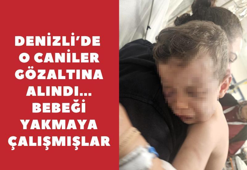 Denizli'de o caniler gözaltına alındı... Bebeği yakmaya çalışmışlar