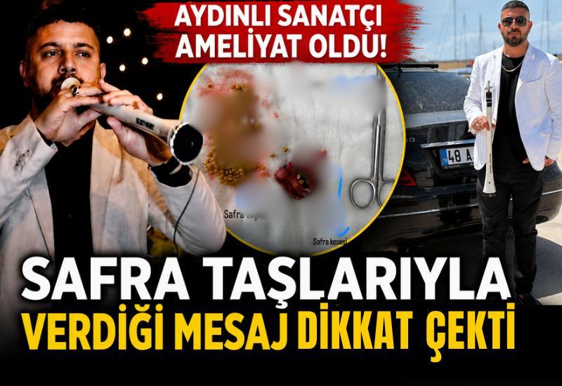 Aydınlı sanatçı ameliyat oldu! Safra taşlarıyla verdiği mesaj dikkat çekti