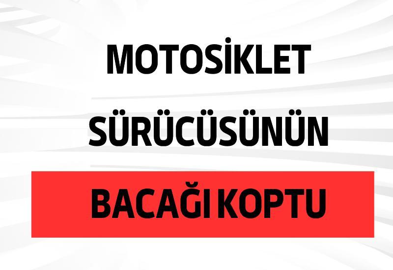 Motosiklet sürücüsünün bacağı koptu