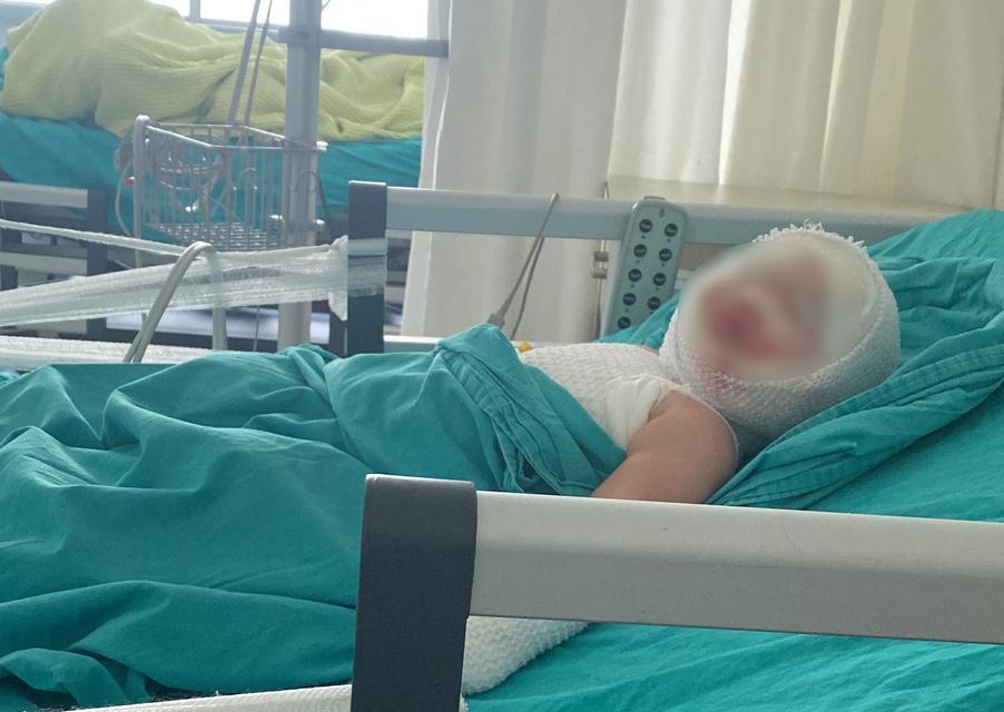 Patlayan domates konservesi 9 aylık bebeği yaktı
