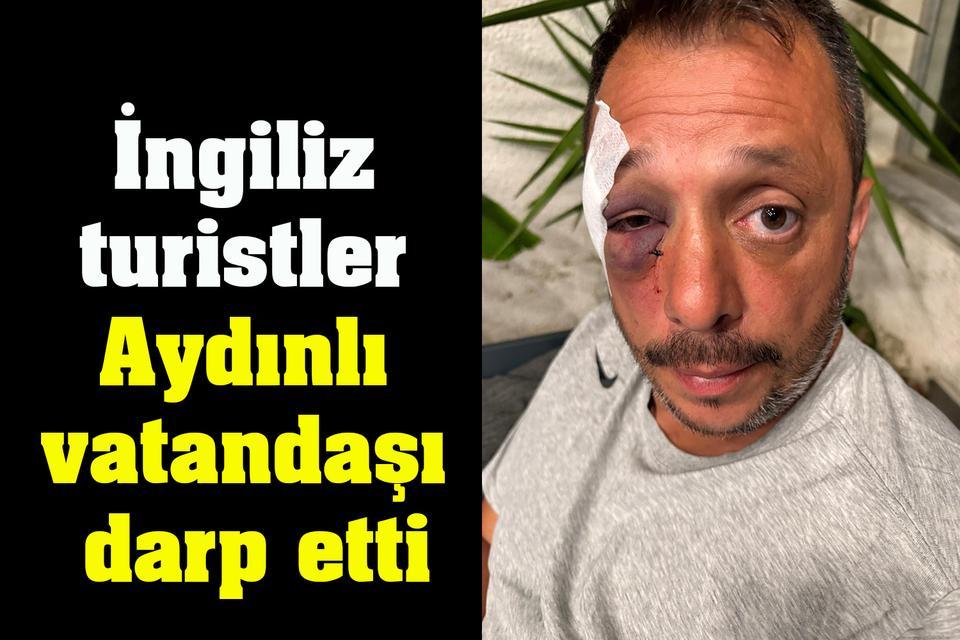 İngiliz turistler Aydınlı vatandaşı darp etti