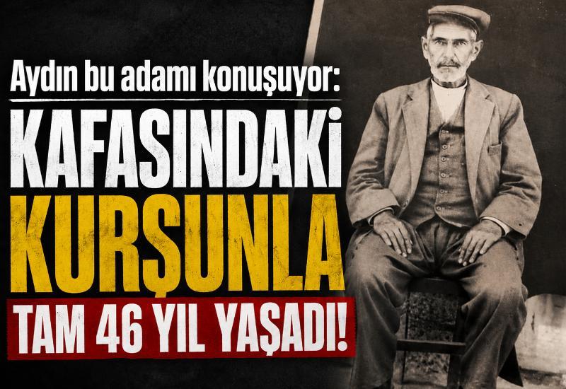 Aydın bu adamı konuşuyor: Kafasındaki kurşunla tam 46 yıl yaşadı