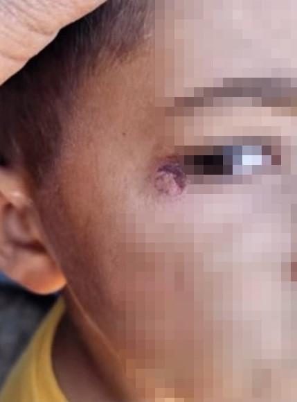 Öğrencinin yüzünde sigara söndürdü!