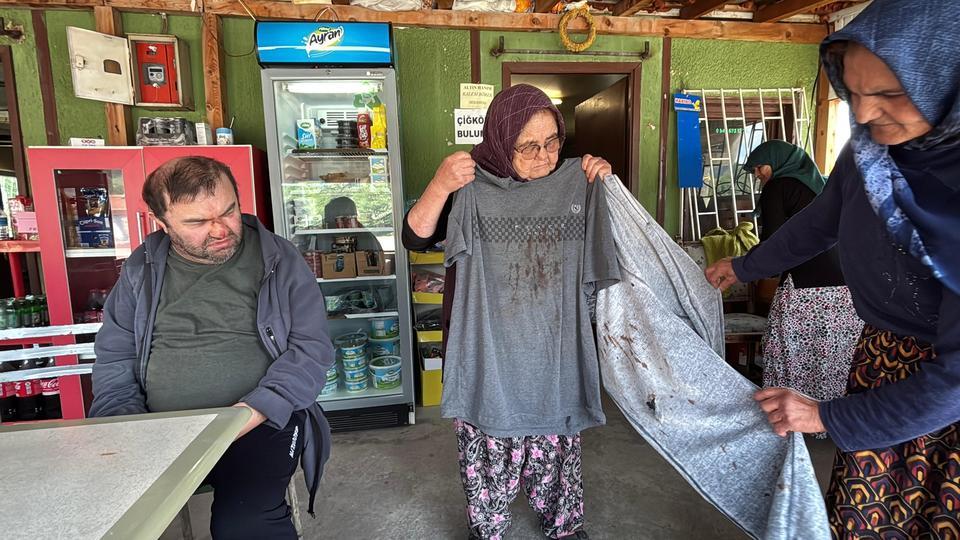 YÜZDE 90 ENGELLİ VATANDAŞ ACIMASIZCA DARP EDİLDİ "DİZLERİ, OMUZLARI VE YÜZÜ YARA İÇİNDE" "KONUŞAMAZ, DUYAR VE KENDİ İHTİYAÇLARINI KENDİ YAPAMAZ"