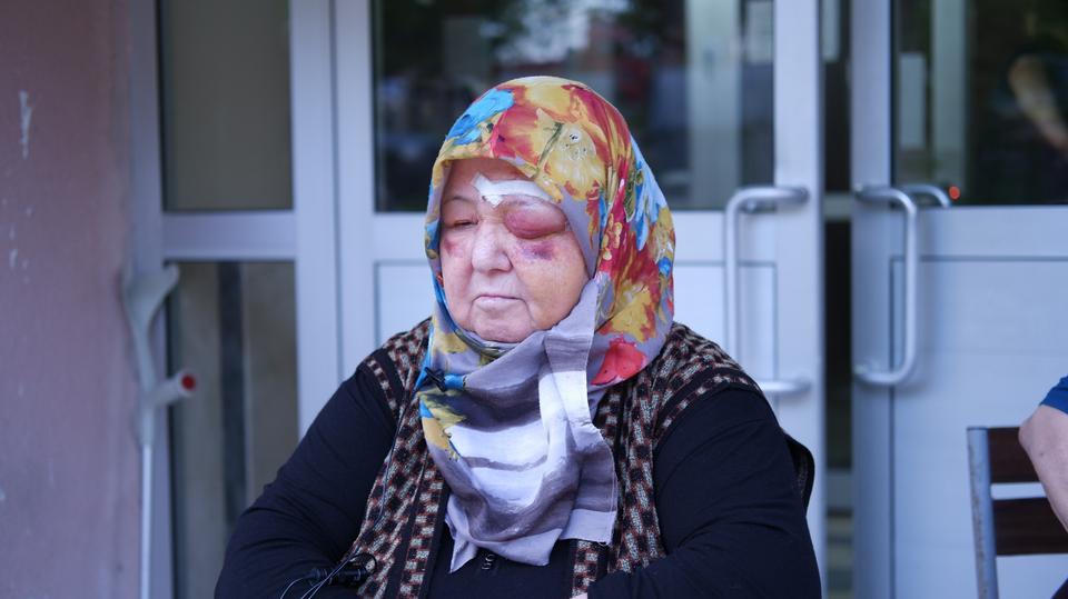 BAŞIBOŞ KÖPEK DEHŞETİ KAMERADA: YARALANAN KADIN TANINMAZ HALE GELDİ