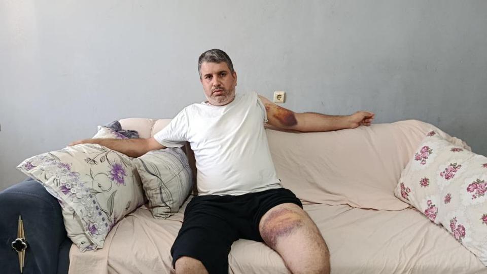 Miras kavgasında yeğenini darbeden dayı tutuklandı