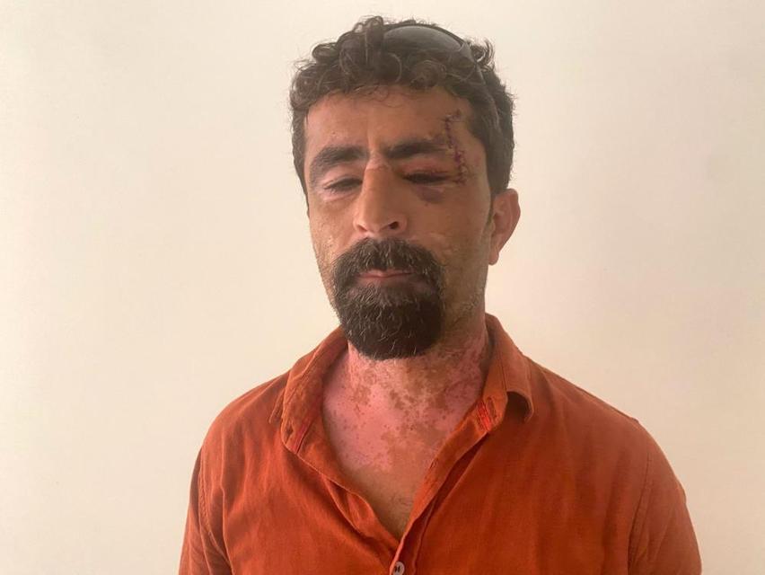 Öfkeli damat kayınpederini hastanelik etti
