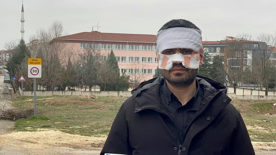 REHBER ÖĞRETMENİN YÜZÜNE SICAK ÇAY FIRLATTIĞI FİZİK ÖĞRETMENİ FECİ ŞEKİLDE YANDI FİZİK ÖĞRETMENİ SERKAN KESKİNBAŞ: "SICAK ÇAYI KASITLI OLARAK YÜZÜME FIRLATTI, BENİ HAŞLADI" "AĞZA ALINMAYACAK AĞIR KÜFÜR ETTİ"