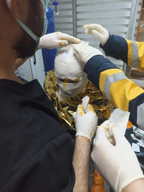 Kömür ocağında yangın: 2 işçi yaralı