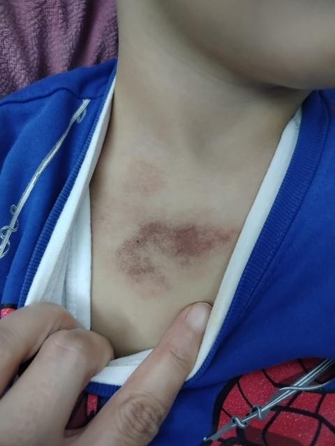 Kreşte istismar ve darp iddiası