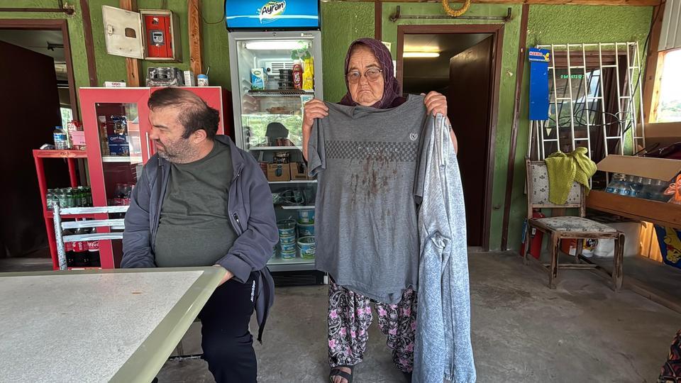 YÜZDE 90 ENGELLİ VATANDAŞ ACIMASIZCA DARP EDİLDİ "DİZLERİ, OMUZLARI VE YÜZÜ YARA İÇİNDE" "KONUŞAMAZ, DUYAR VE KENDİ İHTİYAÇLARINI KENDİ YAPAMAZ"