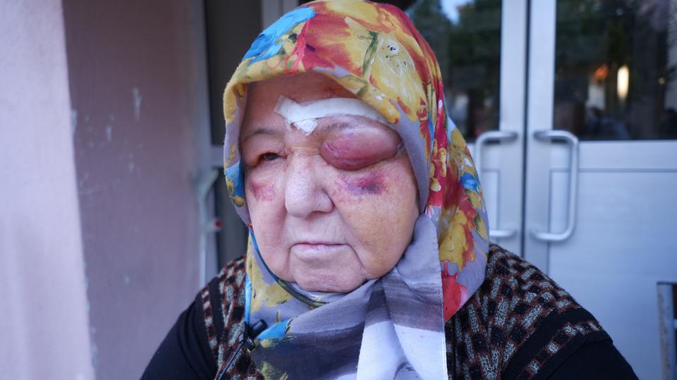 BAŞIBOŞ KÖPEK DEHŞETİ KAMERADA: YARALANAN KADIN TANINMAZ HALE GELDİ