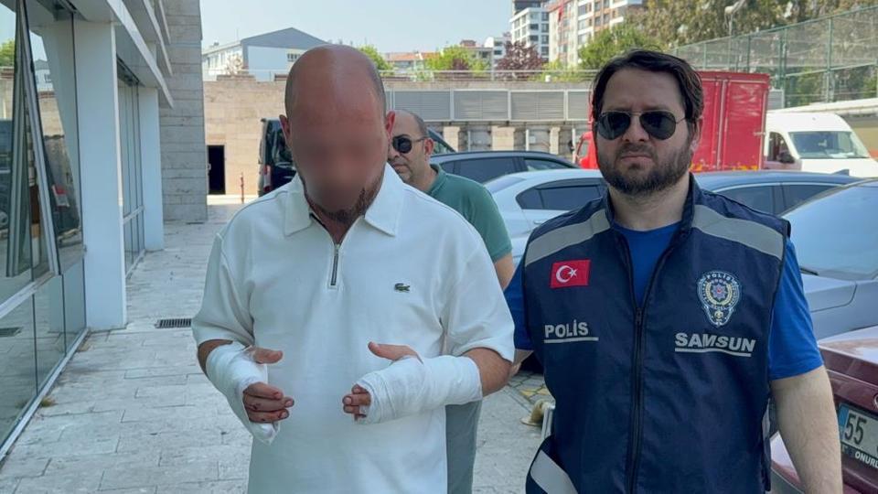 Çocuk tartışması kanlı bitti! Eski eşini hastanelik etti