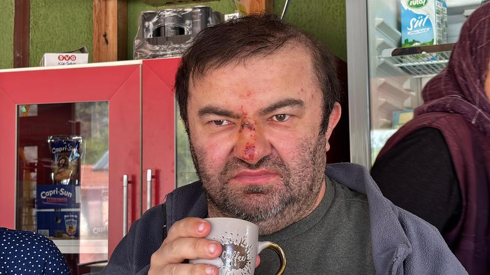 YÜZDE 90 ENGELLİ VATANDAŞ ACIMASIZCA DARP EDİLDİ "DİZLERİ, OMUZLARI VE YÜZÜ YARA İÇİNDE" "KONUŞAMAZ, DUYAR VE KENDİ İHTİYAÇLARINI KENDİ YAPAMAZ"