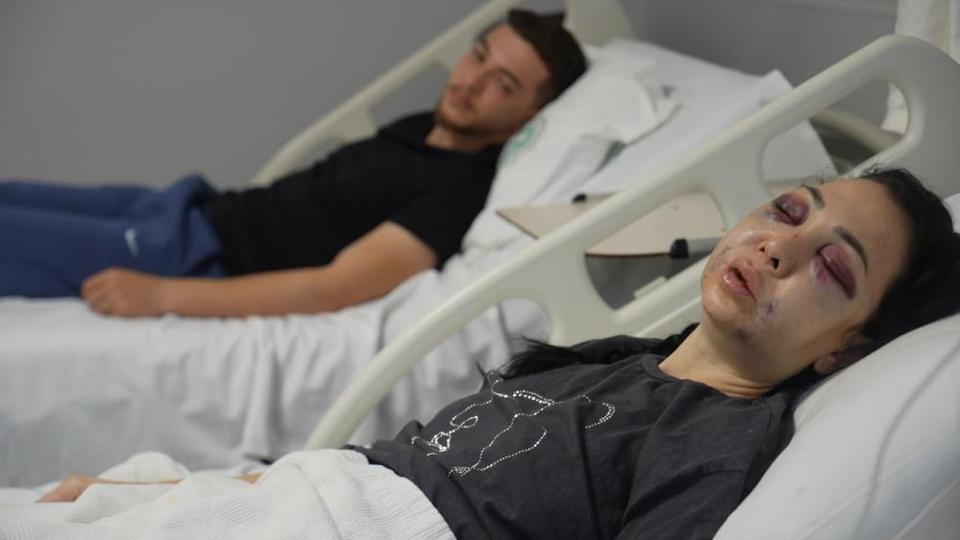 Anne ve oğlu darp edildi: 1 tutuklu