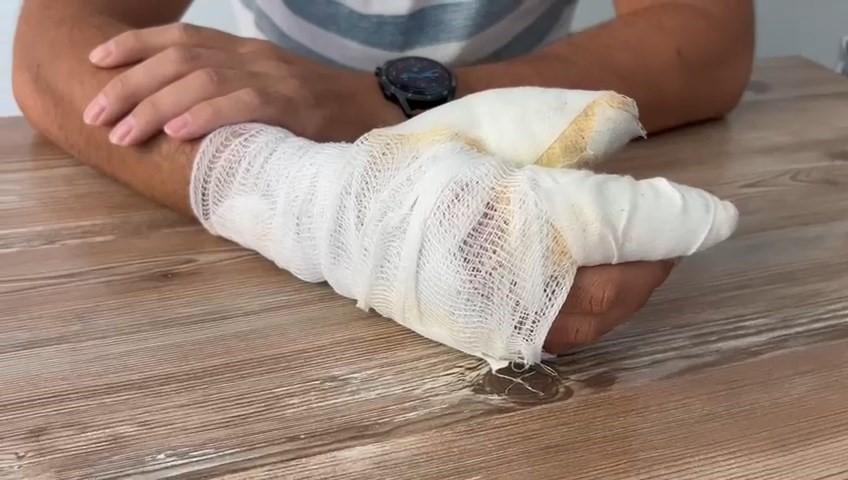 BİNGÖL'DE CEP TELEFONU BATARYASI BİR ANDA PATLADI: O ANLAR GÜVENLİK KAMERASINDA