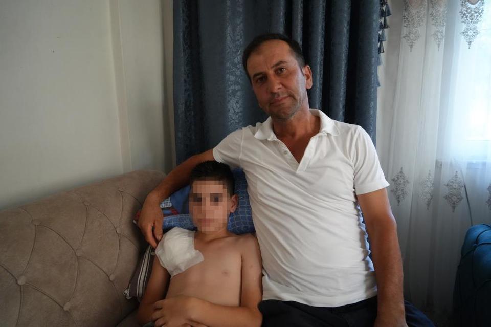 Vücudu köpek tarafından parçalanan Yunus'un kolu kullanılamaz hale geldi