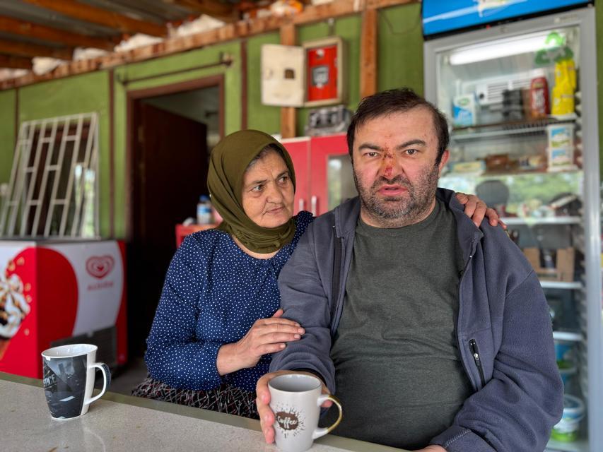 YÜZDE 90 ENGELLİ VATANDAŞ ACIMASIZCA DARP EDİLDİ "DİZLERİ, OMUZLARI VE YÜZÜ YARA İÇİNDE" "KONUŞAMAZ, DUYAR VE KENDİ İHTİYAÇLARINI KENDİ YAPAMAZ"