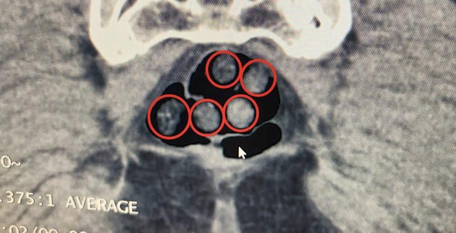 Uyuşturucu operasyonunda 3 kişi tutuklandı