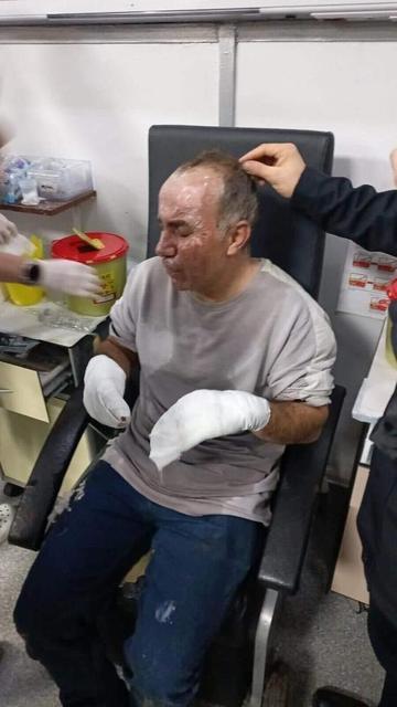 Minibüs alev topuna döndü: Şoför can havliyle atladı, yaralandı