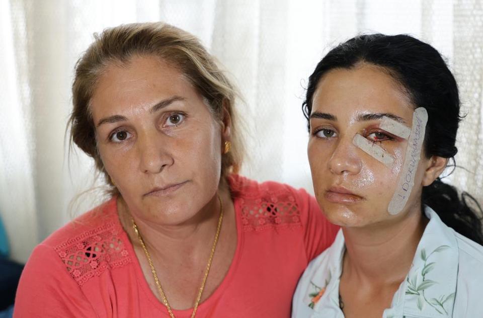 Eski eşinden şiddet gören kadın: "Ben yaşarken kurtulayım, öldükten sonra değil"
