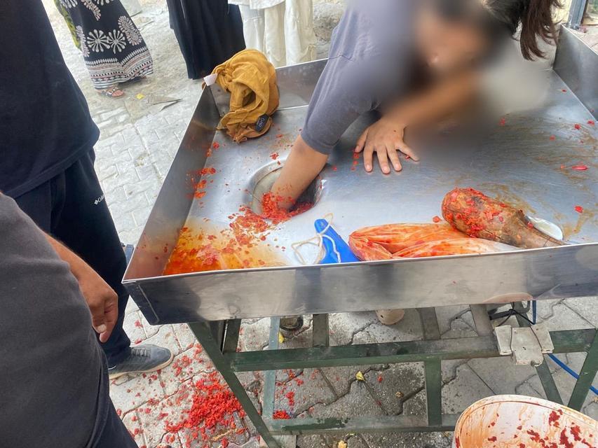 Elini salça makinesine kaptırdı