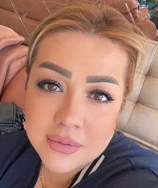 BOTOKS BU HALE GETİRDİ: YÜZÜ ŞİŞTİ TANINMAYACAK HALE GELDİ BOTOKS MAĞDURU KADIN: "SİZ DE BİLMEDİĞİNİZ HİÇBİR YERE GİTMEYİN, DOKTOR HARİCİ KİMSEYE YAPTIRMAYIN ARKADAŞLAR"