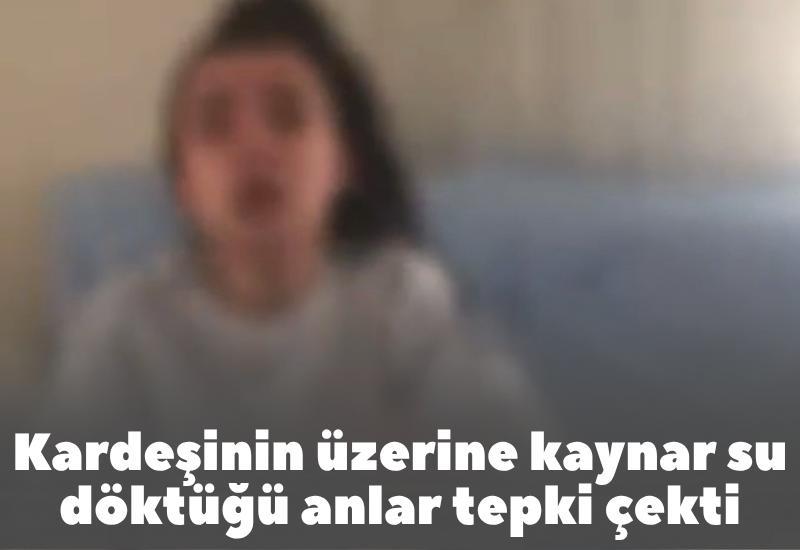 Kardeşinin üzerine kaynar su döktüğü anlar tepki çekti