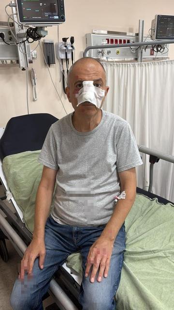 Önce icra yoluyla evinden tahliye edildi, ardından darp edildi