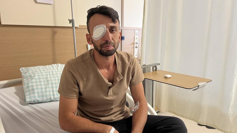 Balkondan açılan ateşte gözünden yaralandı