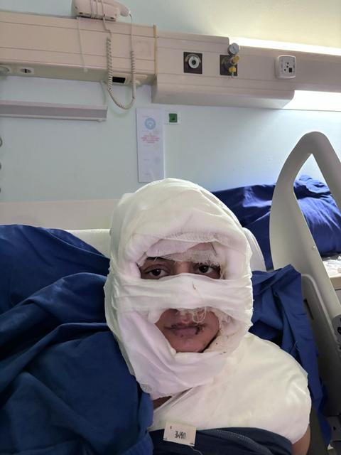 Akıl almaz olay: Genç kadın başka bir kadın tarafından ateşe verildi