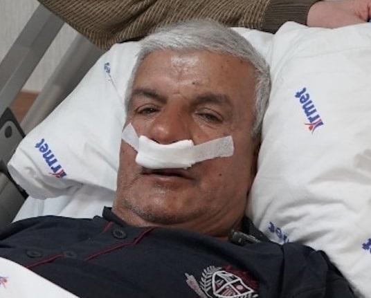 Burnundan 100 gramlık taş çıkarıldı