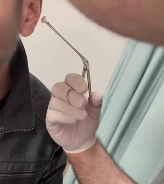 Uyuşturucu kulağından çıktı