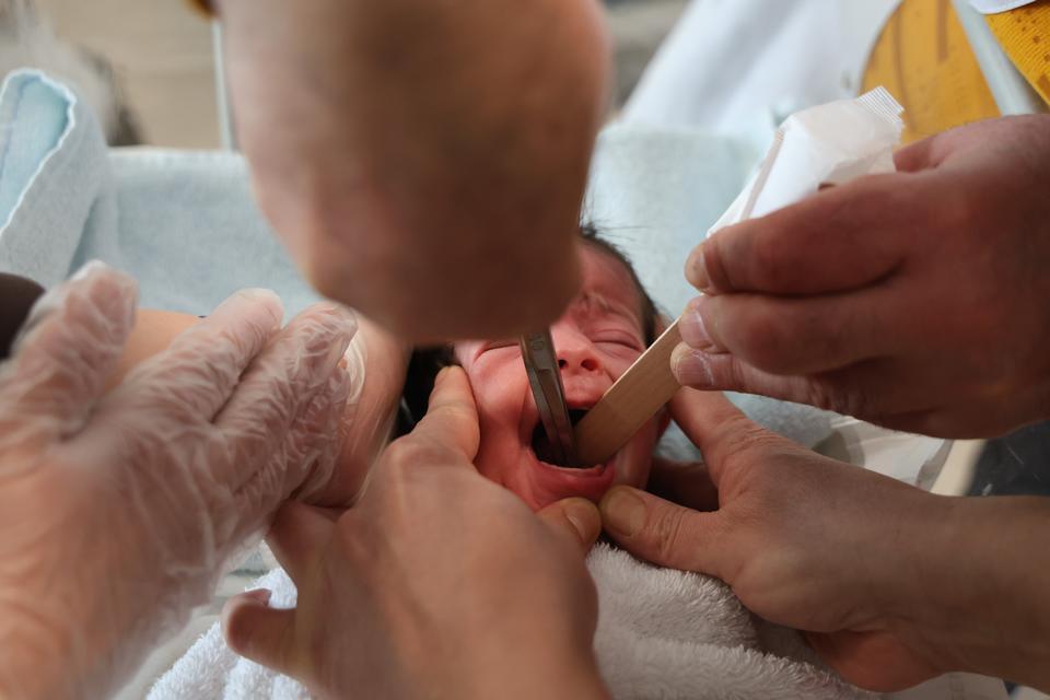 Doğuştan yemek borusu olmayan 4 günlük bebek hayata tutundu