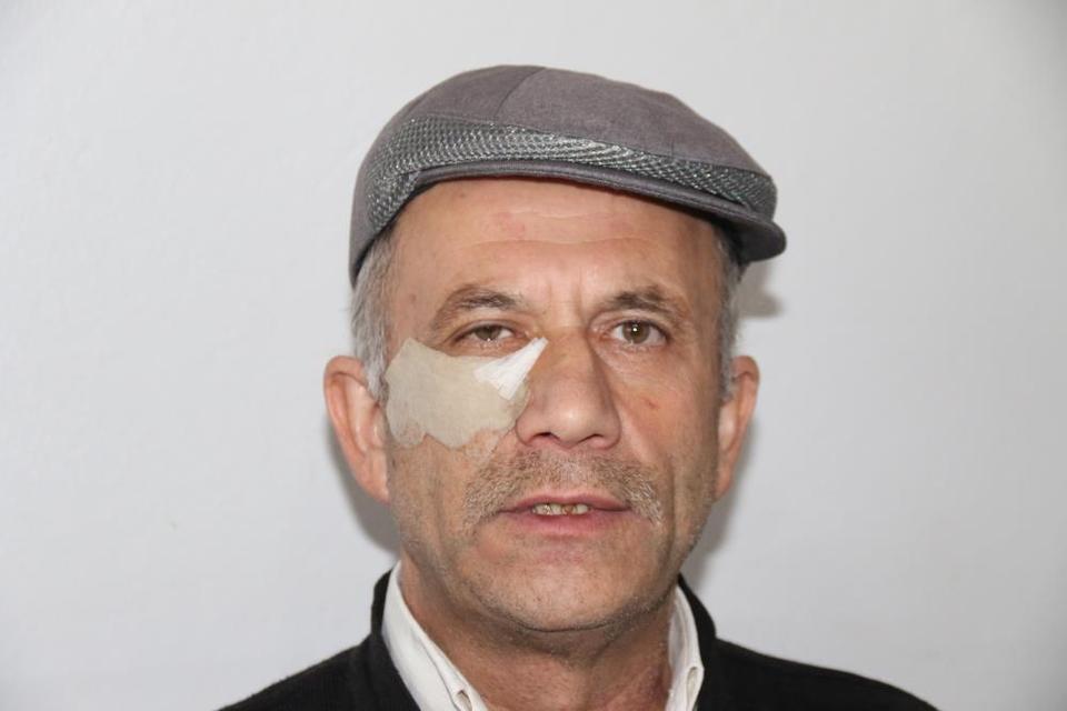 Yavru kedilere mama götürürken dayak yedi