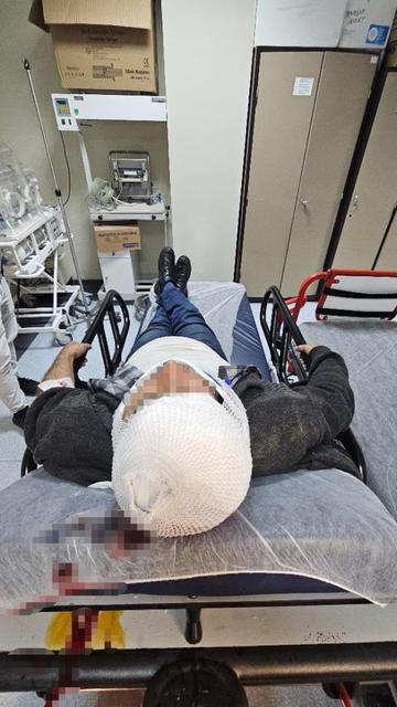 Merdivenden düşen şahıs yaralandı