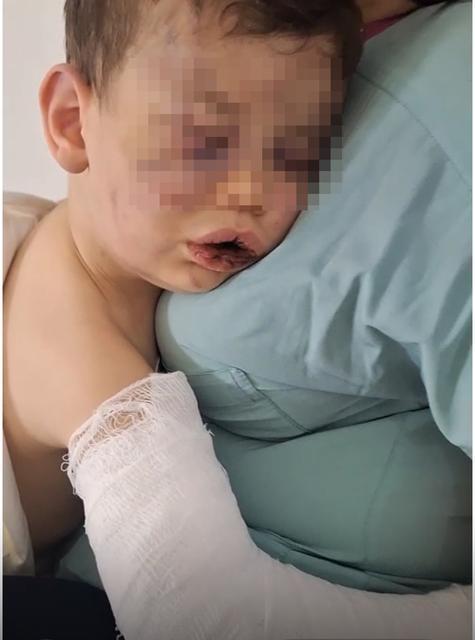 Darp edilen o bebek devlet korumasına alınacak