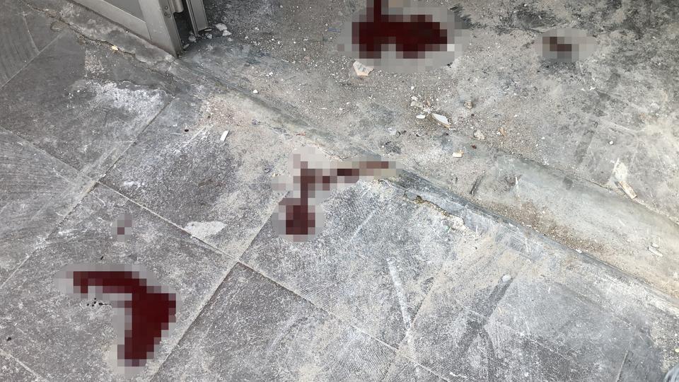 HASTANEYE KALDIRILIRKEN BİLE TELEFONU ELİNDEN BIRAKMADI TADİLATTA İSKELEDEN DÜŞEN ADAM BACAĞINDAN YARALANDI