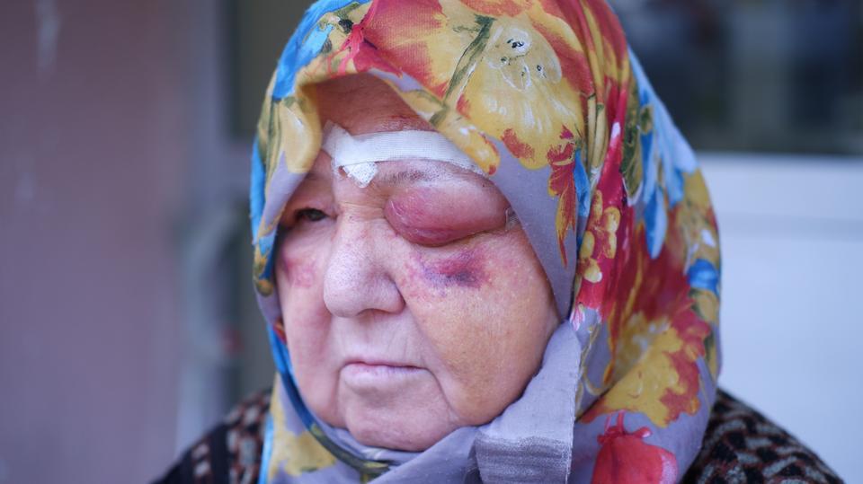 BAŞIBOŞ KÖPEK DEHŞETİ KAMERADA: YARALANAN KADIN TANINMAZ HALE GELDİ