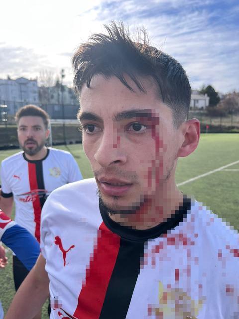 Maç sonrası 3 futbolcu hastanelik oldu