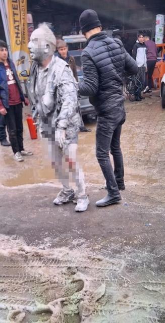 Oto sanayi dükkanında patlama: 1 ölü