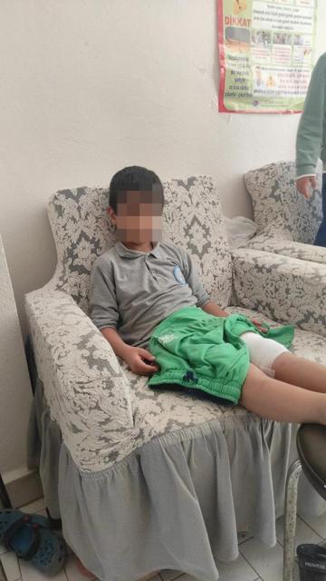 8 yaşındaki çocuk okula giderken sokak köpeğinin saldırısına uğradı